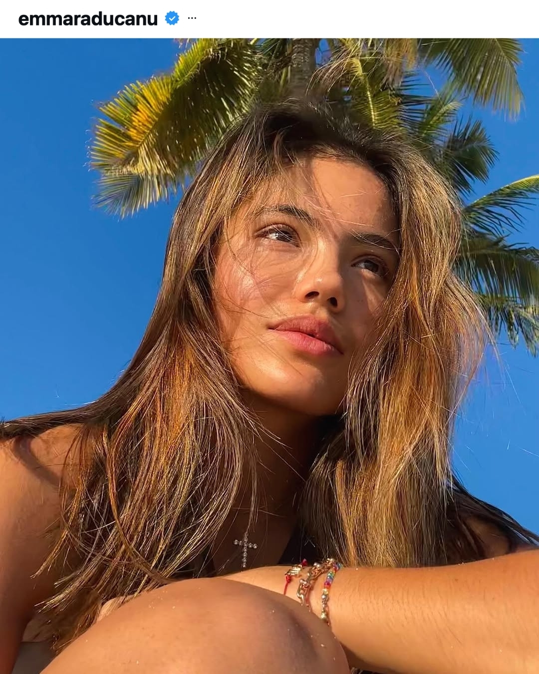 Emma Raducanu 2024 Resurgence